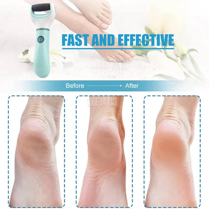 Electric Foot Grinder Dead Skin Remover Feet Scrubber Callus Shaver Remove Dry Dead Cracked Safe Foot Care Tool