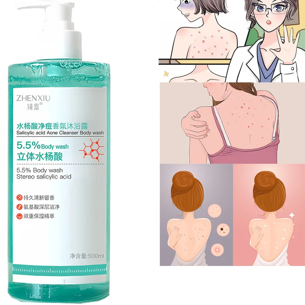 16.9 oz Salicylic Acid Body Wash, Gentle &amp; Smoothing  Mild Exfoliating Daily Acne Body Wash Deep Cleanses Back Acne and Sebum