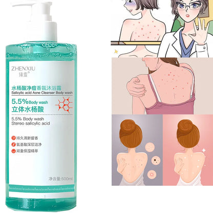16.9 oz Salicylic Acid Body Wash, Gentle &amp; Smoothing  Mild Exfoliating Daily Acne Body Wash Deep Cleanses Back Acne and Sebum